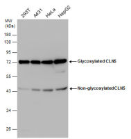 CLN5 antibody