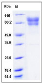 Human Factor IX protein, His tag (active)