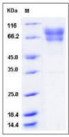 Human Factor IX protein, His tag (active)