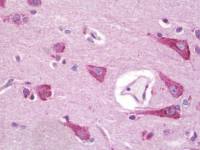 Apelin Receptor antibody