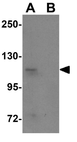 SCUBE1 antibody