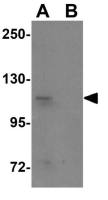 SCUBE1 antibody