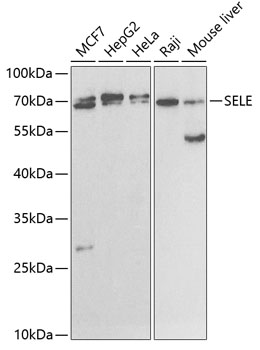 CD62E antibody