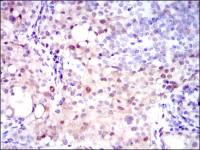 ASS1 antibody [2C10]