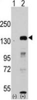 FBXL11 antibody, Internal