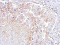 Annexin VI antibody [C2C3], C-term