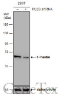 T-Plastin antibody