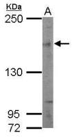 SIN3B antibody [N1N2-2], N-term