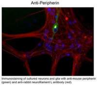 Peripherin antibody [7C5]