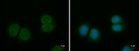 SPINK1 antibody