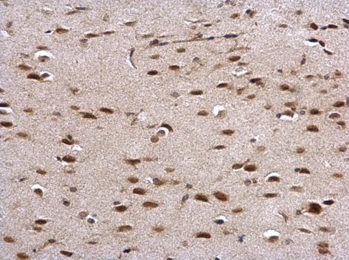 Prion Protein (PrP) antibody