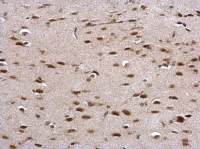 Prion Protein (PrP) antibody