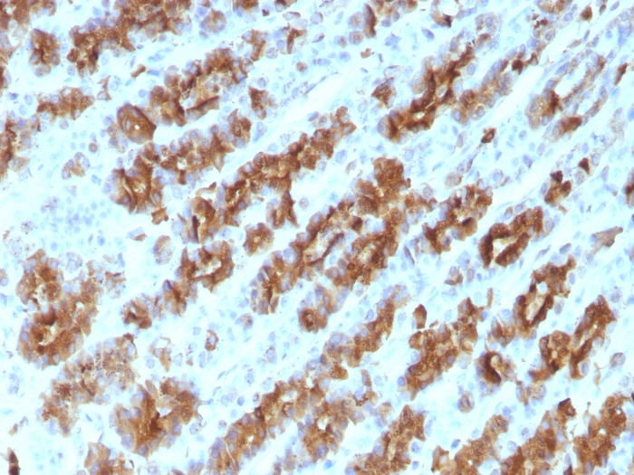 TNF alpha antibody [TNFA/1172]