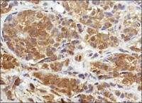 NQO1 antibody [A180]