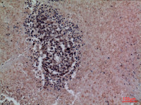 Surfactant protein A2 antibody