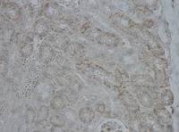 CPS1 antibody, Internal