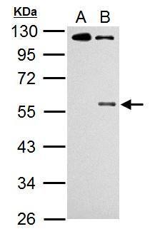 Chk1 (phospho Ser345) antibody [C1C2], Internal