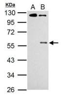 Chk1 (phospho Ser345) antibody [C1C2], Internal