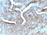 Thymidine Phosphorylase antibody [TYMP/2890R]