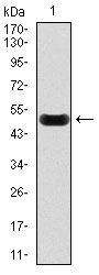 C Reactive Protein antibody [1G1]