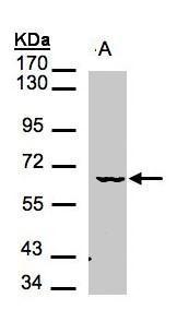 MAK antibody [N1N3]