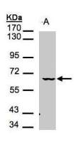 MAK antibody [N1N3]