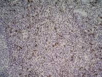 NKG2D antibody [1D11]