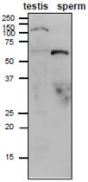 ADAM1B antibody [#158]