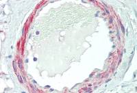 VPS35 antibody, C-term