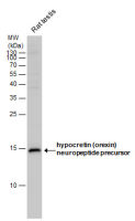 Orexin B antibody