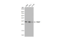 TIRAP antibody [GT1343]