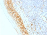 beta Catenin antibody [CTNNB1/1509]