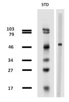 beta Tubulin antibody [TU-13]