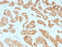 AMACR antibody [AMACR/1723]