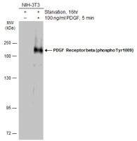 PDGF Receptor beta (phospho Tyr1009) antibody