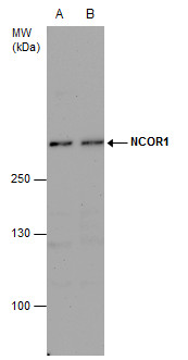 NCOR1 antibody