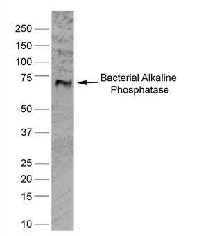 Alkaline Phosphatase antibody [BGN/03/662]