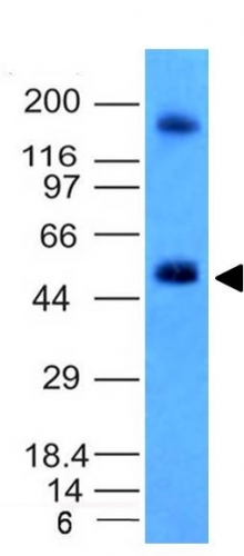 Carbonic Anhydrase IX antibody [CA9/781]