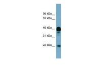FAM45B antibody, Internal