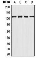 Androgen Receptor (phospho Tyr363) antibody