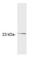 GCAP2 antibody [A1]