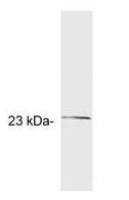 GCAP2 antibody [A1]