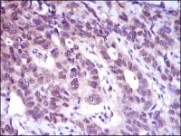 ATP citrate lyase antibody [5F8D11]