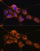 C1 inhibitor antibody