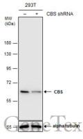 CBS antibody