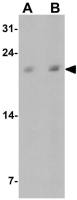 C19orf80 antibody