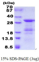 Human SLD5 protein, His tag