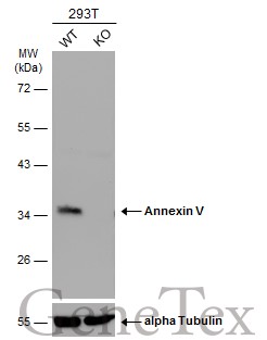 Annexin V antibody