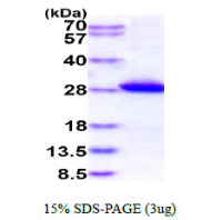 Human GSTM1 protein, His tag