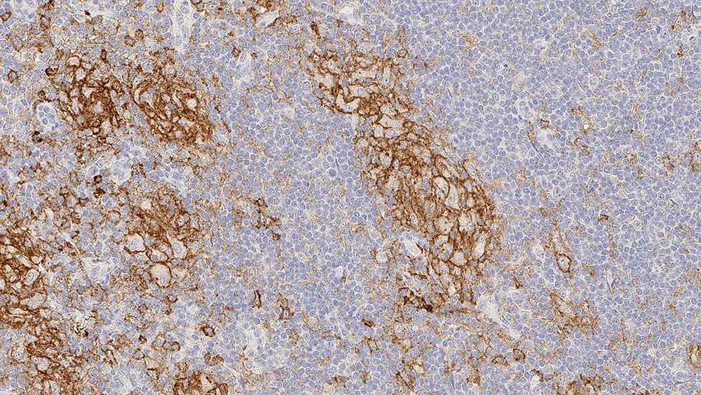 CD33 antibody [PWS44]